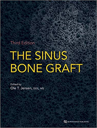 The Sinus Bone Graft (3rd Edition)